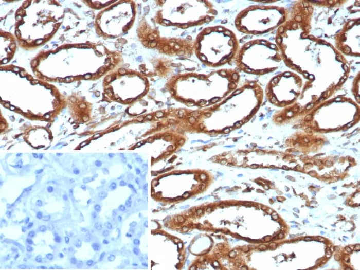 Calnexin Antibody (CANX/9147R) Immunohistochemistry-Paraffin: Calnexin Antibody (CANX/9147R) [NBP3-23890] -