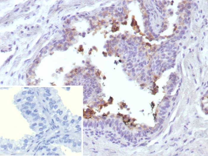 MRP4/ABCC4 Antibody (ABCC4/9018)