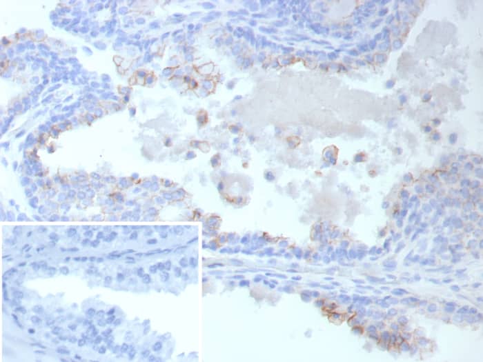 MRP4/ABCC4 Antibody (ABCC4/9019)