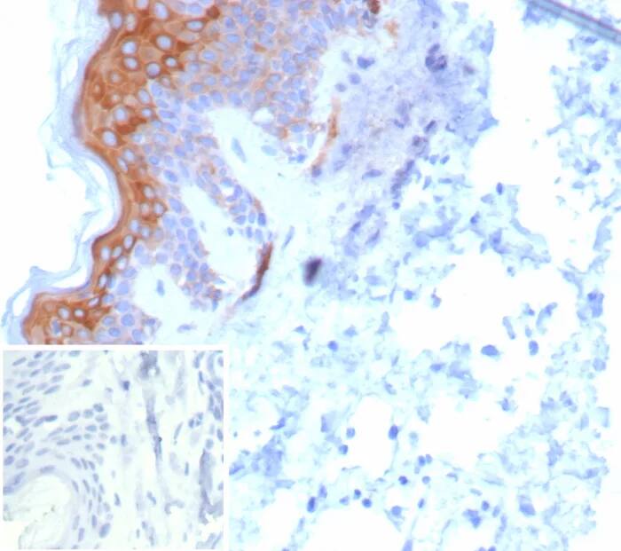 Cytokeratin 6 Antibody (KRT6/8267R) Immunohistochemistry-Paraffin: Cytokeratin 6 Antibody (KRT6/8267R) [NBP3-23895] -