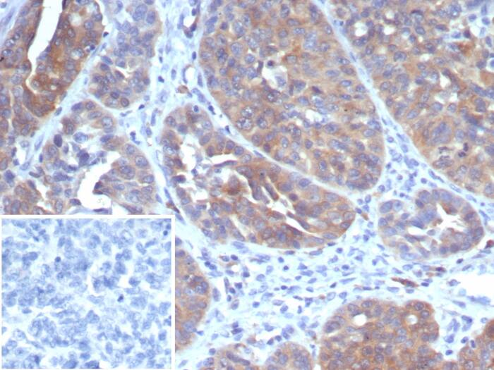 GCLM Antibody (GCLM/4069)