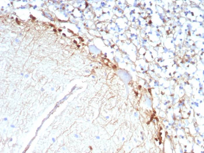 Glutamine Synthetase Antibody (rGLUL/8620)