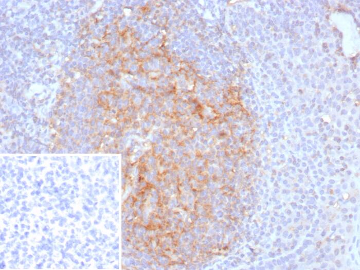 CD35 Antibody (CR1/8282R)