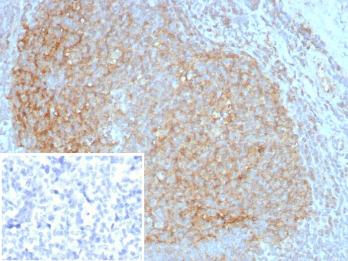 CD35 Antibody (CR1/8283R)