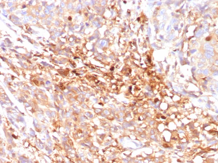 ABCC11 Antibody (ABCC11/2438)