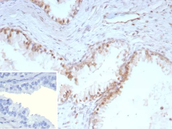 p27/Kip1 Antibody (KIP1/9168R) Immunohistochemistry-Paraffin: p27/Kip1 Antibody (KIP1/9168R) [NBP3-23904] -