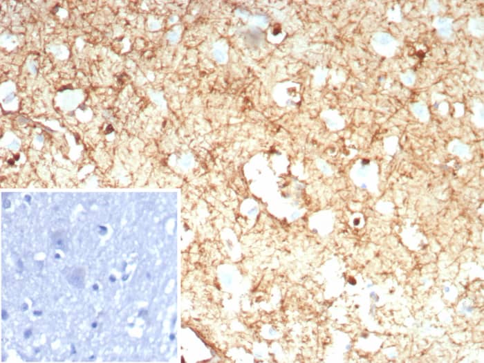 Glutamine Synthetase Antibody (rGLUL/8621)