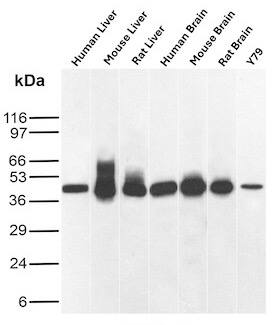 Glutamine Synthetase Antibody (rGLUL/8621) Western Blot: Glutamine Synthetase Antibody (rGLUL/8621) [NBP3-23905] -