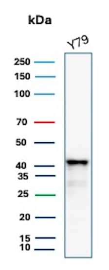 Glutamine Synthetase Antibody (rGLUL/8621) Western Blot: Glutamine Synthetase Antibody (rGLUL/8621) [NBP3-23905] -