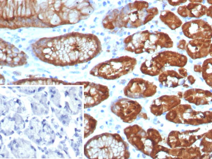 Glutamine Synthetase Antibody (GLUL/8256R)