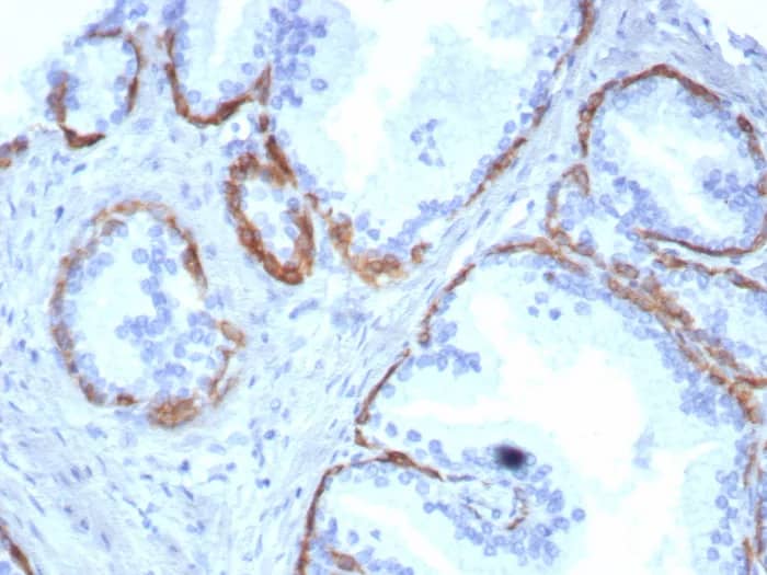 Cytokeratin 14 Antibody (KRT14/8261R) Immunohistochemistry-Paraffin: Cytokeratin 14 Antibody (KRT14/8261R) [NBP3-23908] -