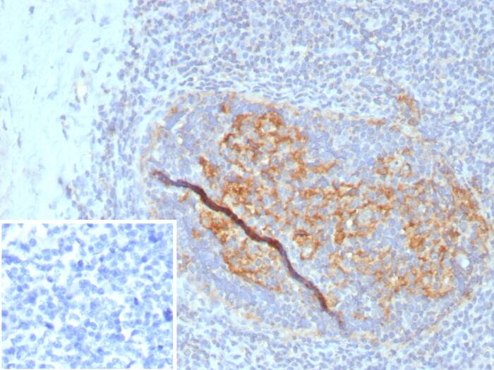 CD35 Antibody (CR1/8284R)