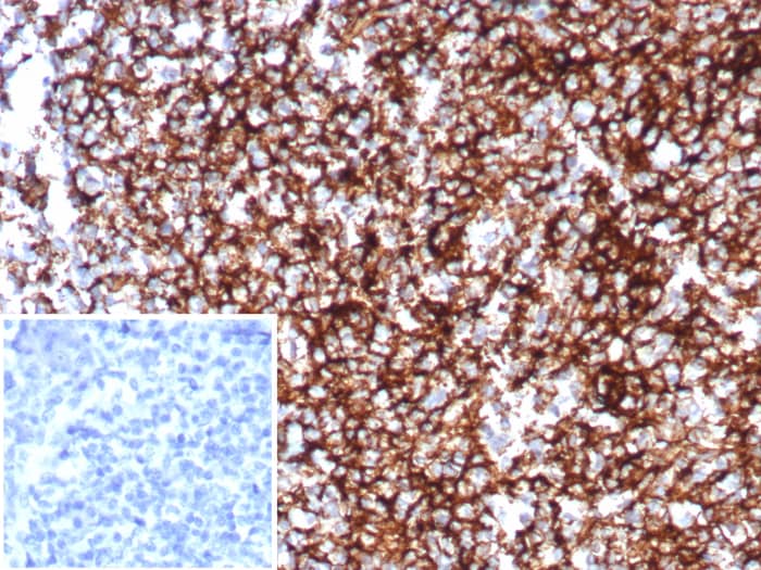 CD35 Antibody (CR1/8598R)