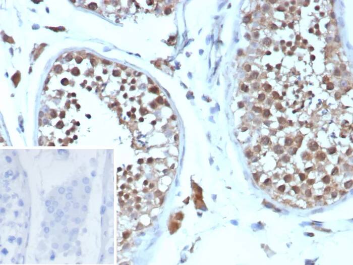 Cyclin B1 Antibody (CCNB1/9242R) Immunohistochemistry-Paraffin: Cyclin B1 Antibody (CCNB1/9242R) [NBP3-23914] -