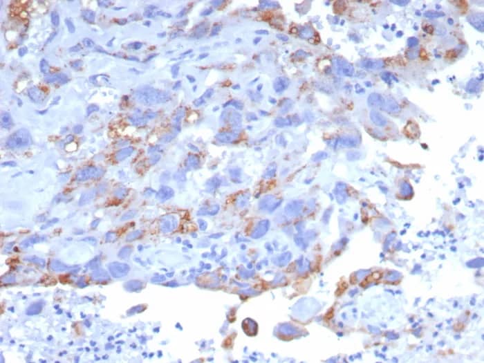 GPRC5A/RAI3 Antibody (GPRC5A/7893) Immunohistochemistry-Paraffin: GPRC5A/RAI3 Antibody (GPRC5A/7893) [NBP3-23915] -