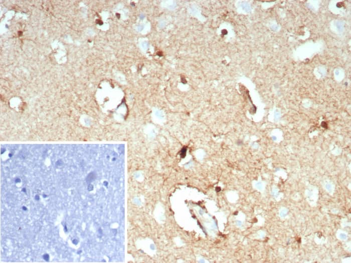 Glutamine Synthetase Antibody (GLUL/8619R)