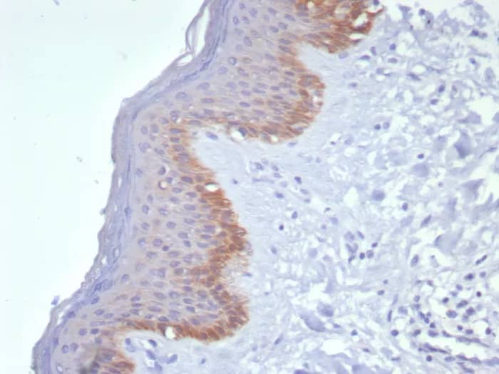 Cytokeratin 15 Antibody (KRT15/8312R) Immunohistochemistry-Paraffin: Cytokeratin 15 Antibody (KRT15/8312R) [NBP3-23918] -