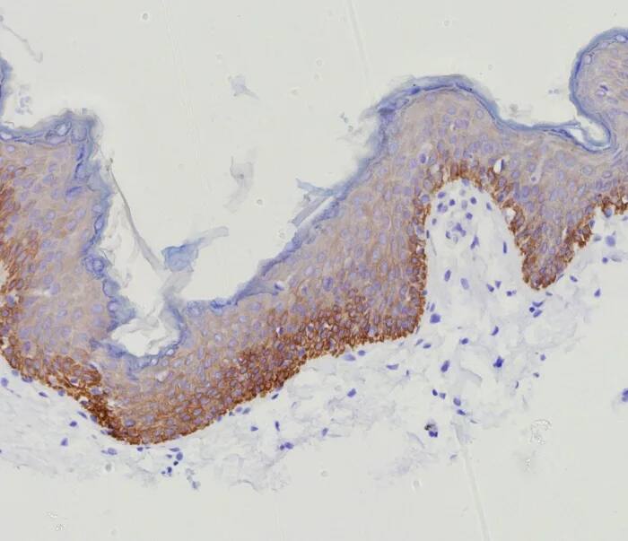 Cytokeratin 15 Antibody (KRT15/9088R) Immunohistochemistry-Paraffin: Cytokeratin 15 Antibody (KRT15/9088R) [NBP3-23919] -