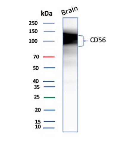 NCAM-1/CD56 Antibody (NCAM1/9074R) Western Blot: NCAM-1/CD56 Antibody (NCAM1/9074R) [NBP3-23922] -