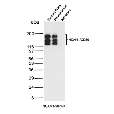 NCAM-1/CD56 Antibody (NCAM1/9074R) Western Blot: NCAM-1/CD56 Antibody (NCAM1/9074R) [NBP3-23922] -