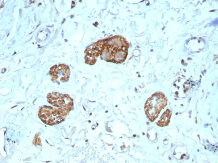 NCAM-1/CD56 Antibody (NCAM1/9121R) Immunohistochemistry-Paraffin: NCAM-1/CD56 Antibody (NCAM1/9121R) [NBP3-23923] -