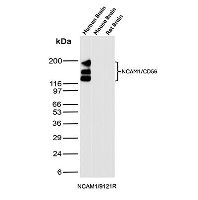 NCAM-1/CD56 Antibody (NCAM1/9121R) Western Blot: NCAM-1/CD56 Antibody (NCAM1/9121R) [NBP3-23923] -