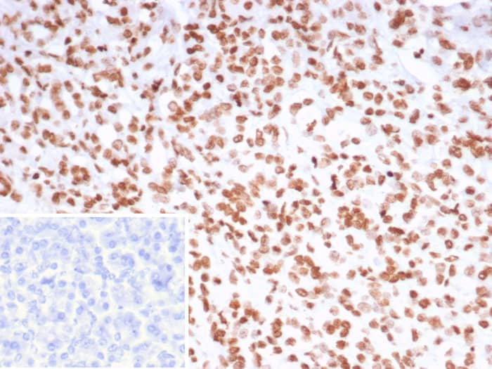 Pet1 Antibody (FEV/7311)