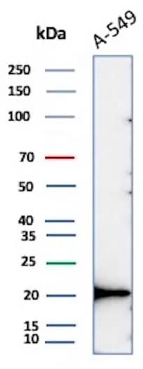 Bax Antibody (BAX/8960R) Western Blot: Bax Antibody (BAX/8960R) [NBP3-23929] -