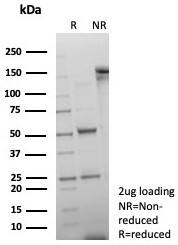 dsDNA Antibody (rDSD/8266)