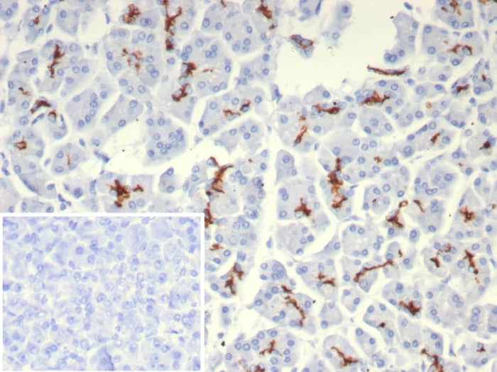 CFTR Antibody (rCFTR/8047)