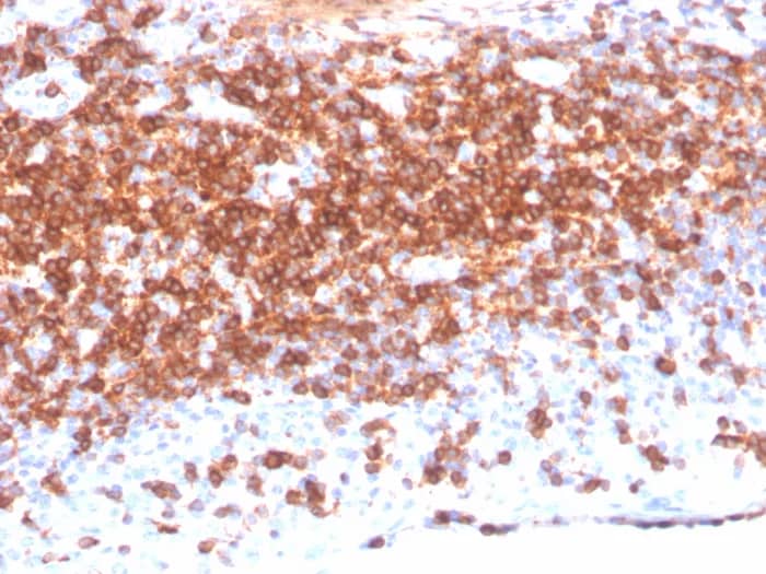 CD7 Antibody (CD7/3868R) Immunohistochemistry-Paraffin: CD7 Antibody (CD7/3868R) [NBP3-23936] -