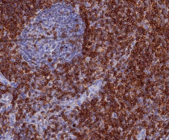 CD7 Antibody (CD7/3868R) Immunohistochemistry-Paraffin: CD7 Antibody (CD7/3868R) [NBP3-23936] -