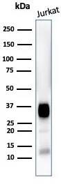 CD7 Antibody (CD7/3868R) Western Blot: CD7 Antibody (CD7/3868R) [NBP3-23936] -