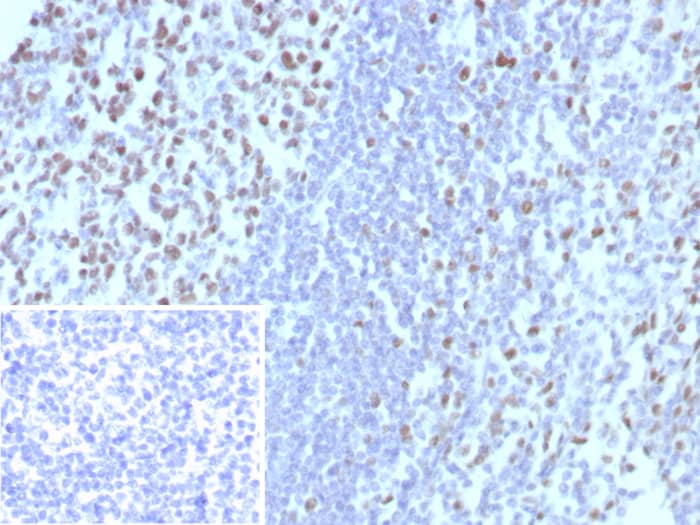 MCM3 Antibody (MCM3/8972R)