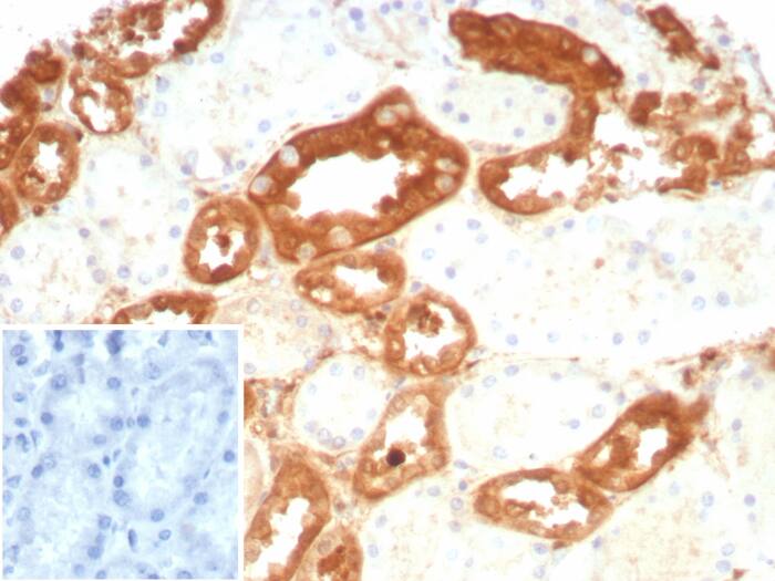 GSTM3 Antibody (rGSTM3/8878)