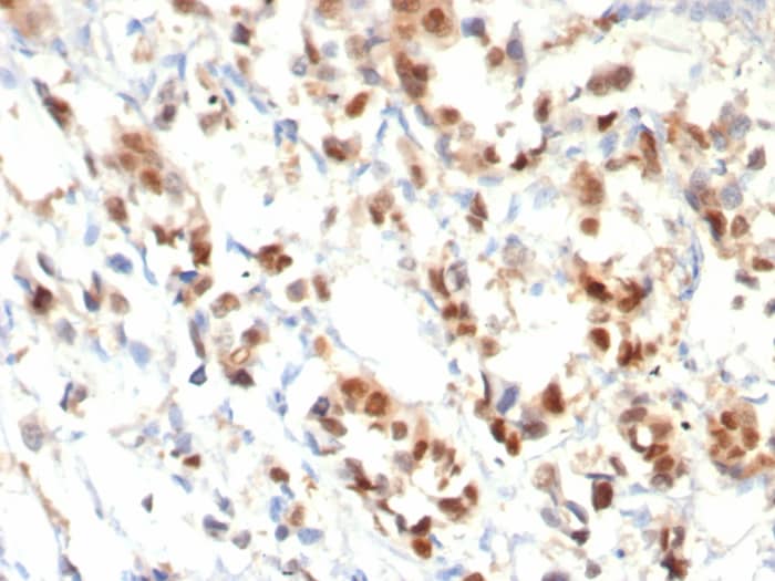 Progesterone R/NR3C3 Antibody (PGR/8099R)