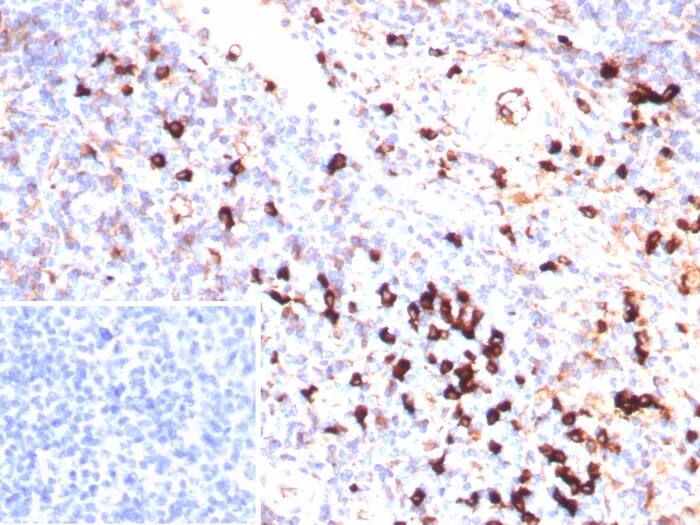 Lambda Light Chain Antibody (IGL/9397R) Immunohistochemistry-Paraffin: Lambda Light Chain Antibody (IGL/9397R) [NBP3-23946] -