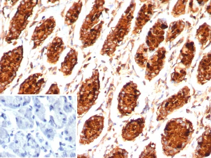 MUC5AC Antibody (MUC5AC/7798R) Immunohistochemistry-Paraffin: MUC5AC Antibody (MUC5AC/7798R) [NBP3-23948] -