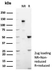 MUC5AC Antibody (MUC5AC/8340R) Immunohistochemistry-Paraffin: MUC5AC Antibody (MUC5AC/8340R) [NBP3-23949] -