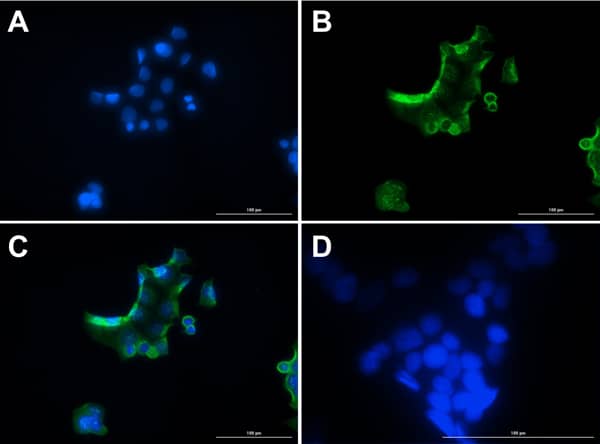 Glucagon Antibody Immunoprecipitation: Glucagon Antibody [NBP3-23954] -