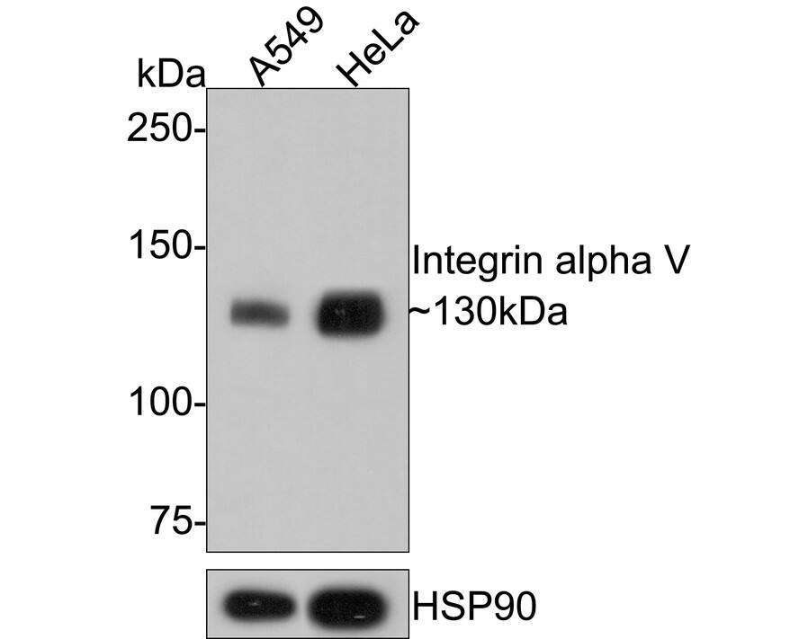 Integrin alpha V/CD51 Antibody (SC56-07) Western Blot: Integrin alpha V/CD51 Antibody (SC56-07) [NBP3-23955]