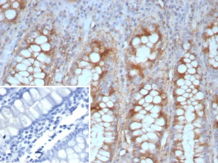 E-Cadherin Antibody (CDH1/9226R) - Azide and BSA Free Immunohistochemistry-Paraffin: E-Cadherin Antibody (CDH1/9226R) - Azide and BSA Free [NBP3-23975] -