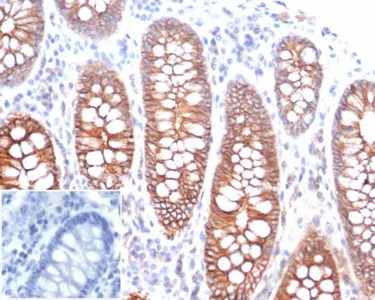 E-Cadherin Antibody (rCDH1/6769) - Azide and BSA Free Immunohistochemistry-Paraffin: E-Cadherin Antibody (rCDH1/6769) - Azide and BSA Free [NBP3-23977] -