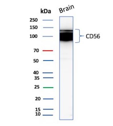 NCAM-1/CD56 Antibody (NCAM1/9121R) - Azide and BSA Free Western Blot: NCAM-1/CD56 Antibody (NCAM1/9121R) - Azide and BSA Free [NBP3-23979] -