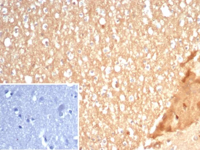 S100A5 Antibody (S100A5/7472) - Azide and BSA Free Immunohistochemistry-Paraffin: S100A5 Antibody (S100A5/7472) - Azide and BSA Free [NBP3-23994] -