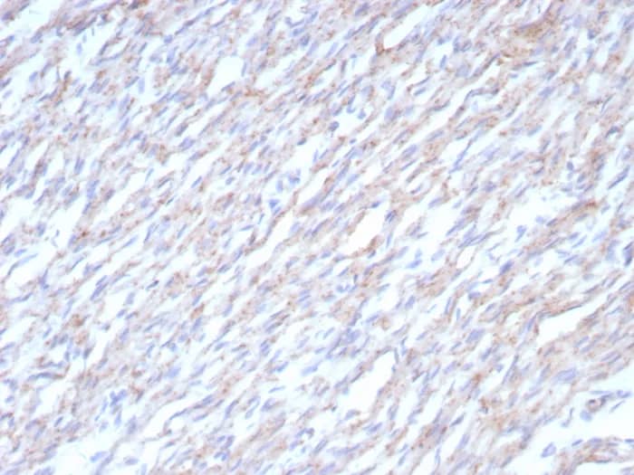 N-Cadherin Antibody (CDH2/8862R) - Azide and BSA Free Immunohistochemistry-Paraffin: N-Cadherin Antibody (CDH2/8862R) - Azide and BSA Free [NBP3-24009] -