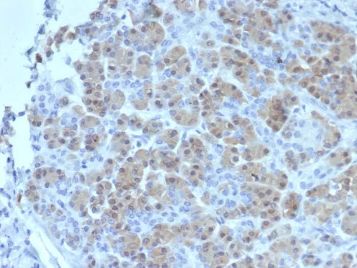 BRCA2 Antibody (BRCA2/2158) - Azide and BSA Free Immunohistochemistry-Paraffin: BRCA2 Antibody (BRCA2/2158) - Azide and BSA Free [NBP3-24027] -