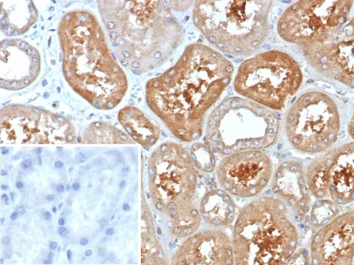 KChIP2 Antibody (KCNIP2/7588) - Azide and BSA Free Immunohistochemistry-Paraffin: KChIP2 Antibody (KCNIP2/7588) - Azide and BSA Free [NBP3-24038] -