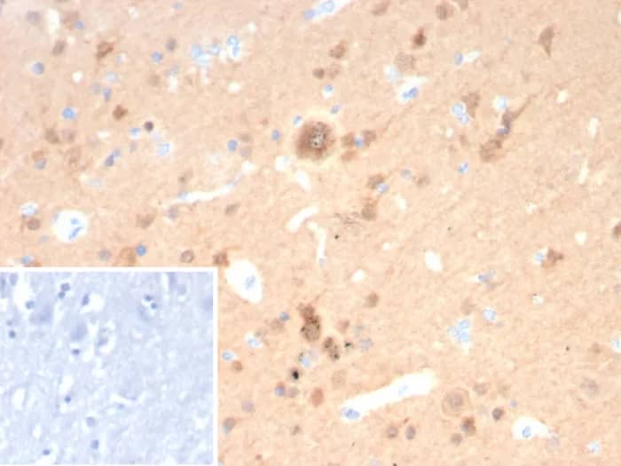 UCH-L1/PGP9.5 Antibody (rUCHL1/8057) - Azide and BSA Free Immunohistochemistry-Paraffin: UCH-L1/PGP9.5 Antibody (rUCHL1/8057) - Azide and BSA Free [NBP3-24044] -