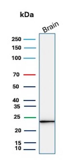 UCH-L1/PGP9.5 Antibody (rUCHL1/8057) - Azide and BSA Free Western Blot: UCH-L1/PGP9.5 Antibody (rUCHL1/8057) - Azide and BSA Free [NBP3-24044] -